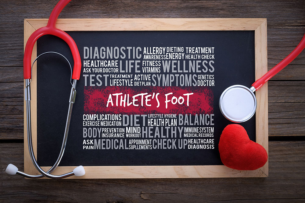 Expert Advice on Athlete's Foot and Your Footwear