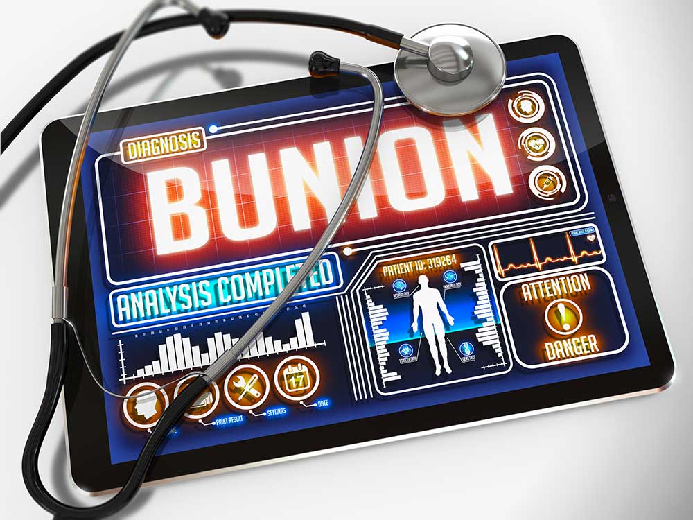 Podiatrist's Electronic  Diagnostic Clipboard that says Bunion on it .