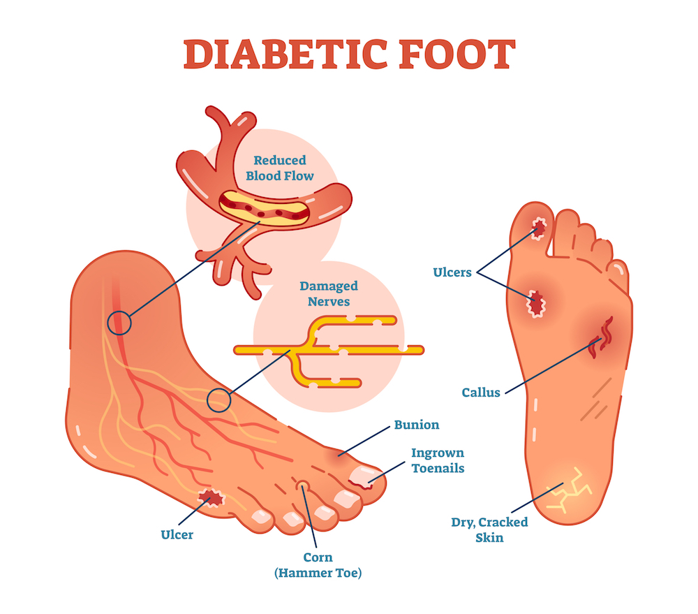 Monitor your overall foot health on a daily basis