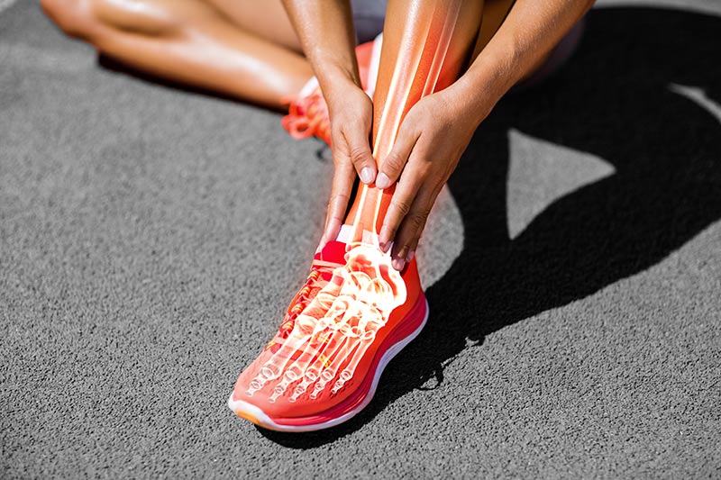 X-ray Image of runner's foot through their sneaker