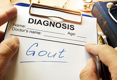 Gout in the Feet | Expert Guide to the Best Shoes for Gout
