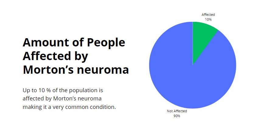 Ten percent of the population is affected with Morton's neuroma