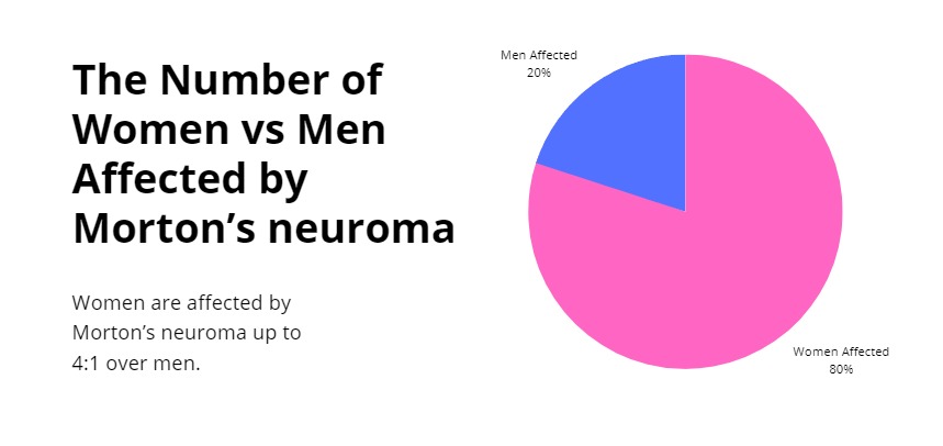 More women than men are affected by Morton's neuroma